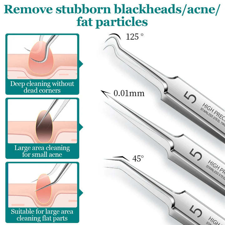 5/8PCS Blackhead Removal Needles Pore Cleaner