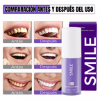 Blanqueador Dental SMILE | Compra 1 y Llévate 2!